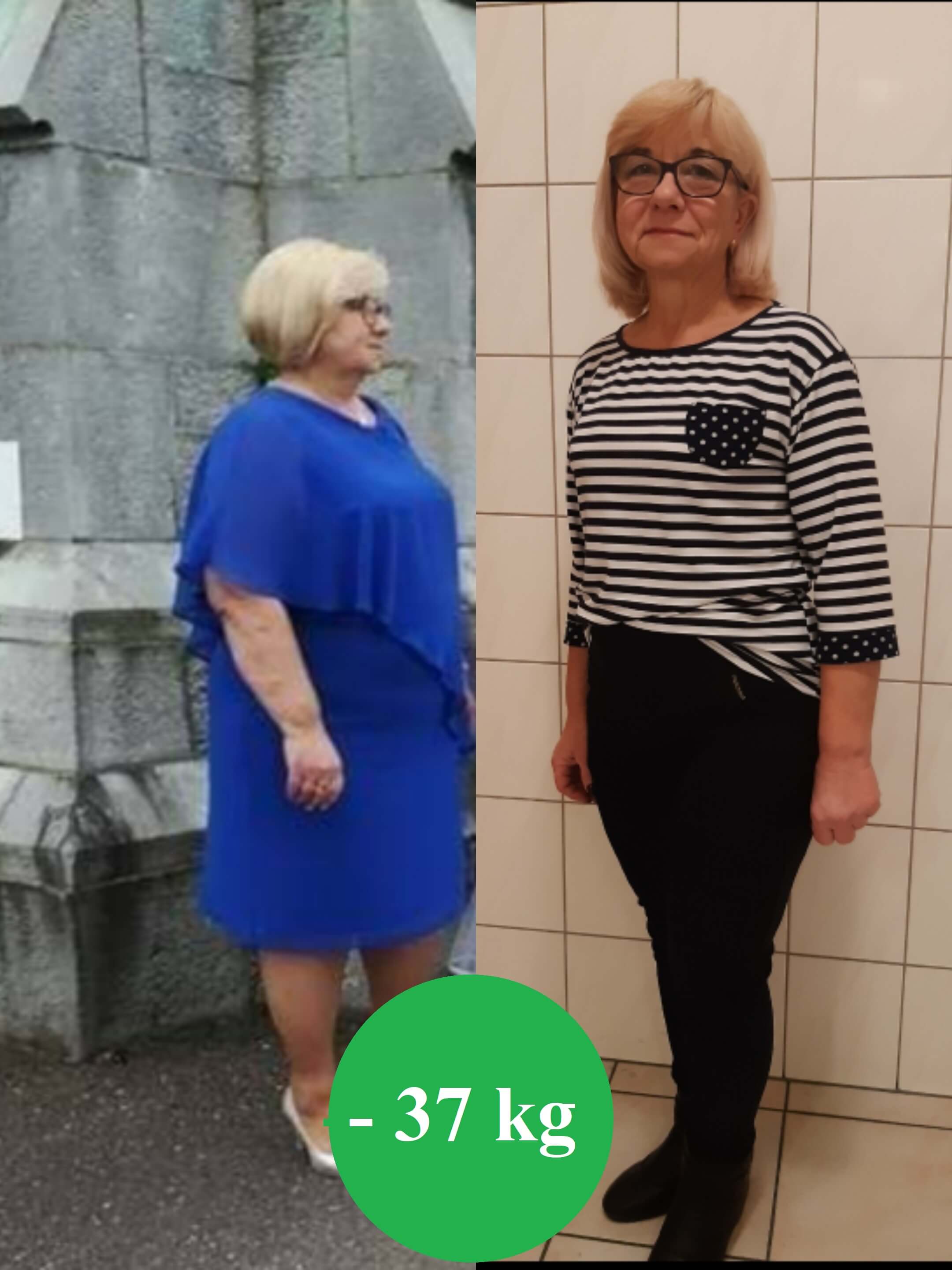 Metamorfoza pacjentki